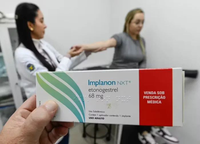 usuarias-do-sus-em-palmas-ja-podem-solicitar-implante-contraceptivo-implanon